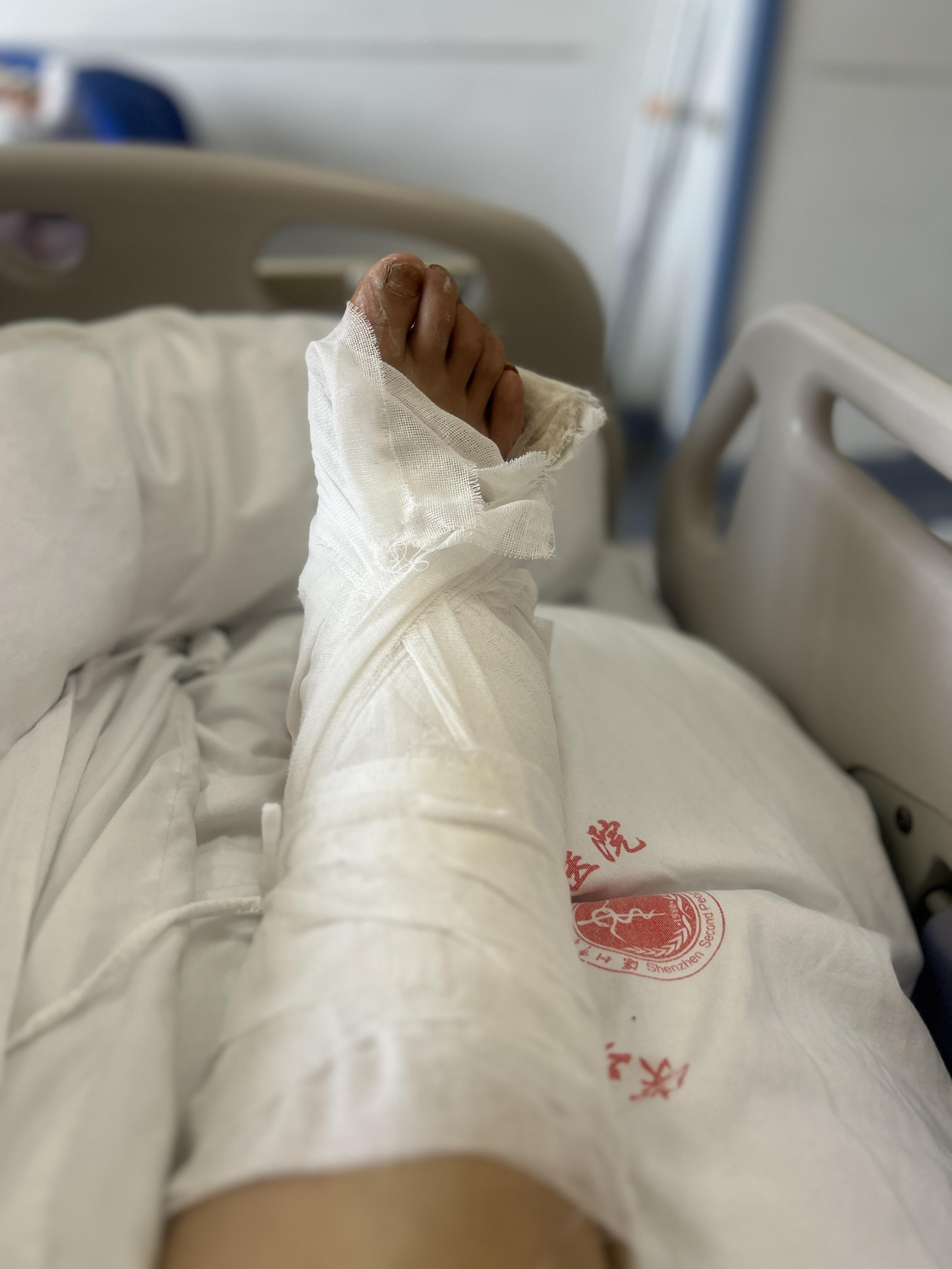 关于九游体育:归化球员费南多伤病康复训练方案与效果评估的信息